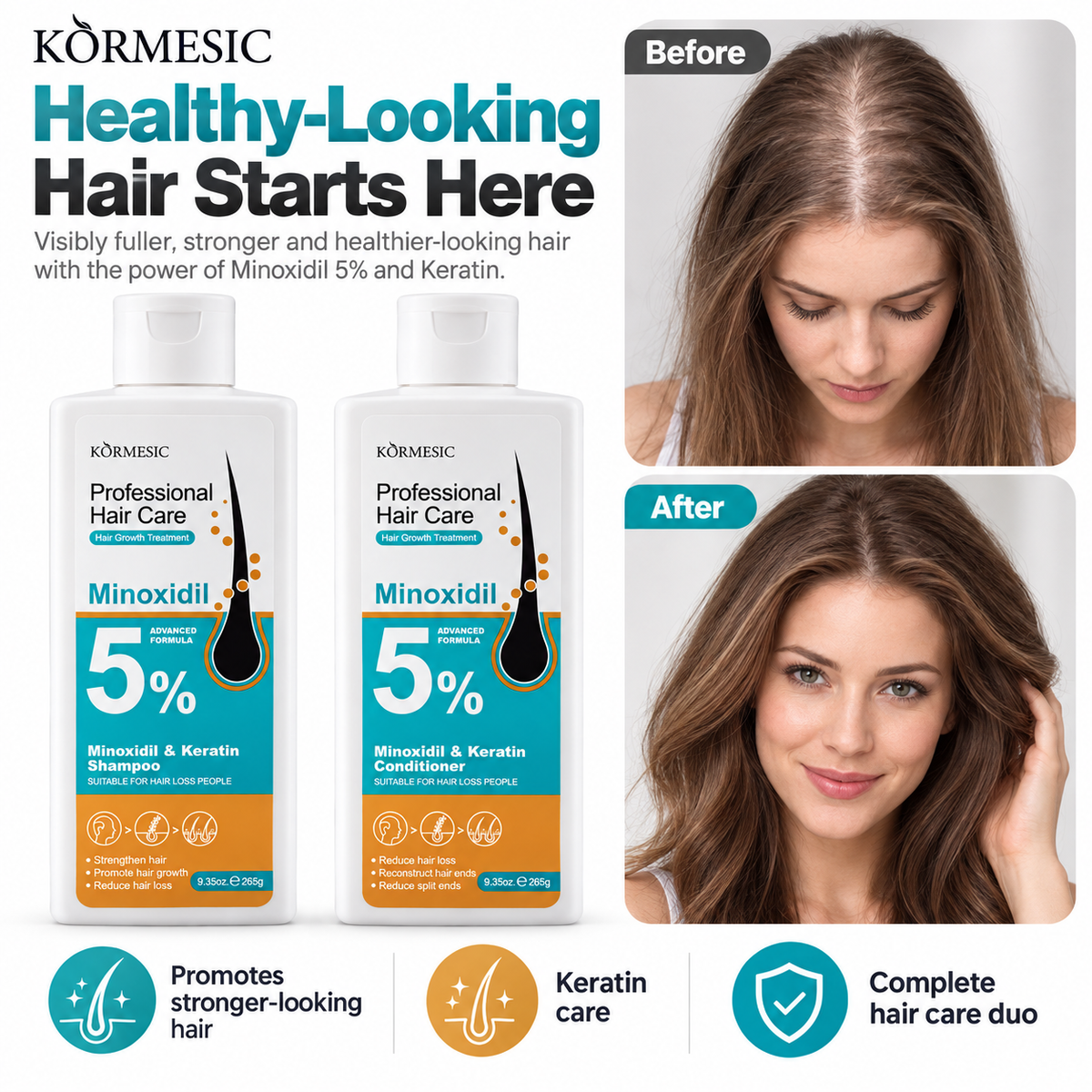KORMESIC 5% Minoxidil & Keratin Shampoo + Conditioner Duo | Hair Growth Care Set