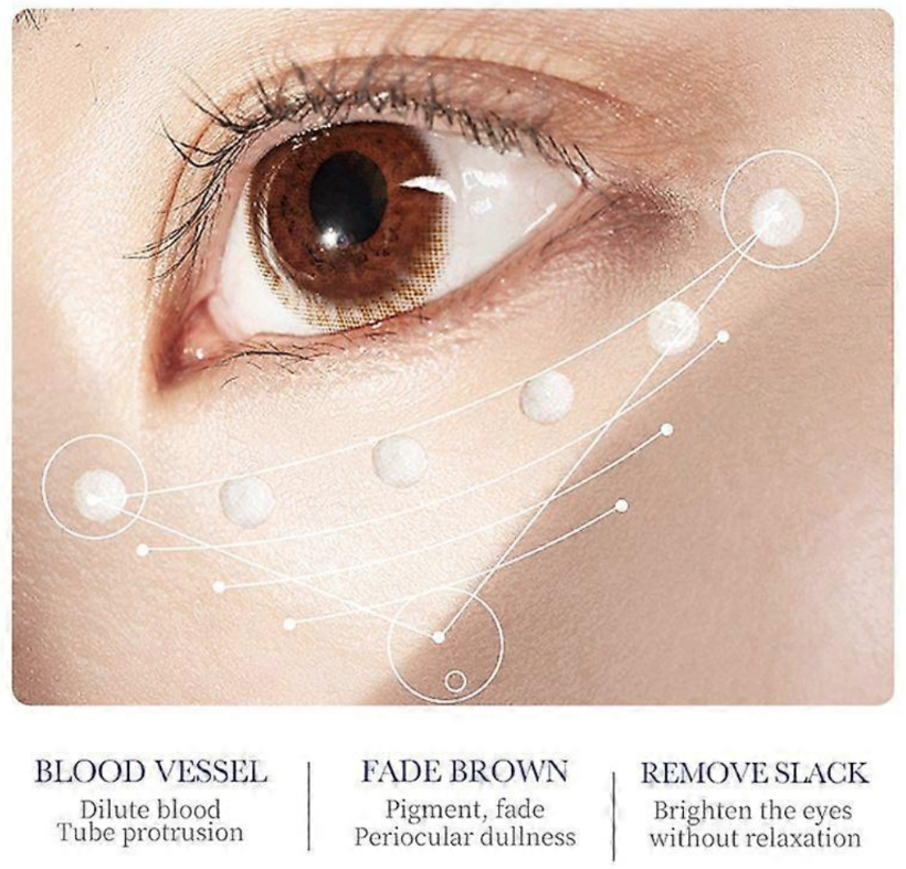 Sadoer Anti-Aging Eye Cream – Hydrating & Firming Treatment for Dark Circles & Wrinkles (30ml)